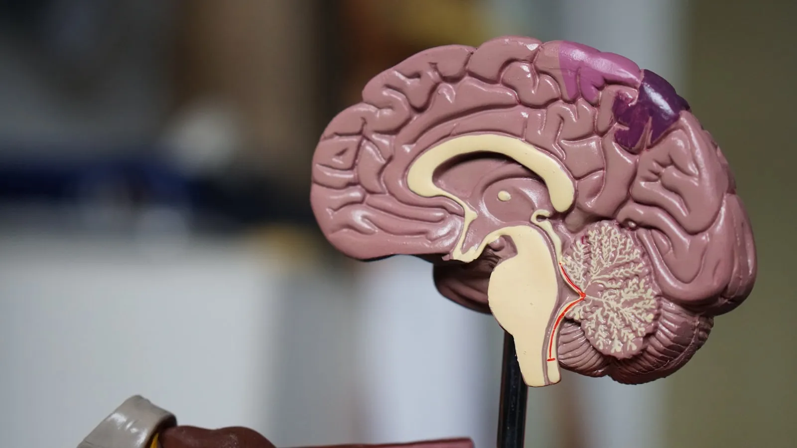 BrainCause: Finding Causal Visual Representations in the Brain